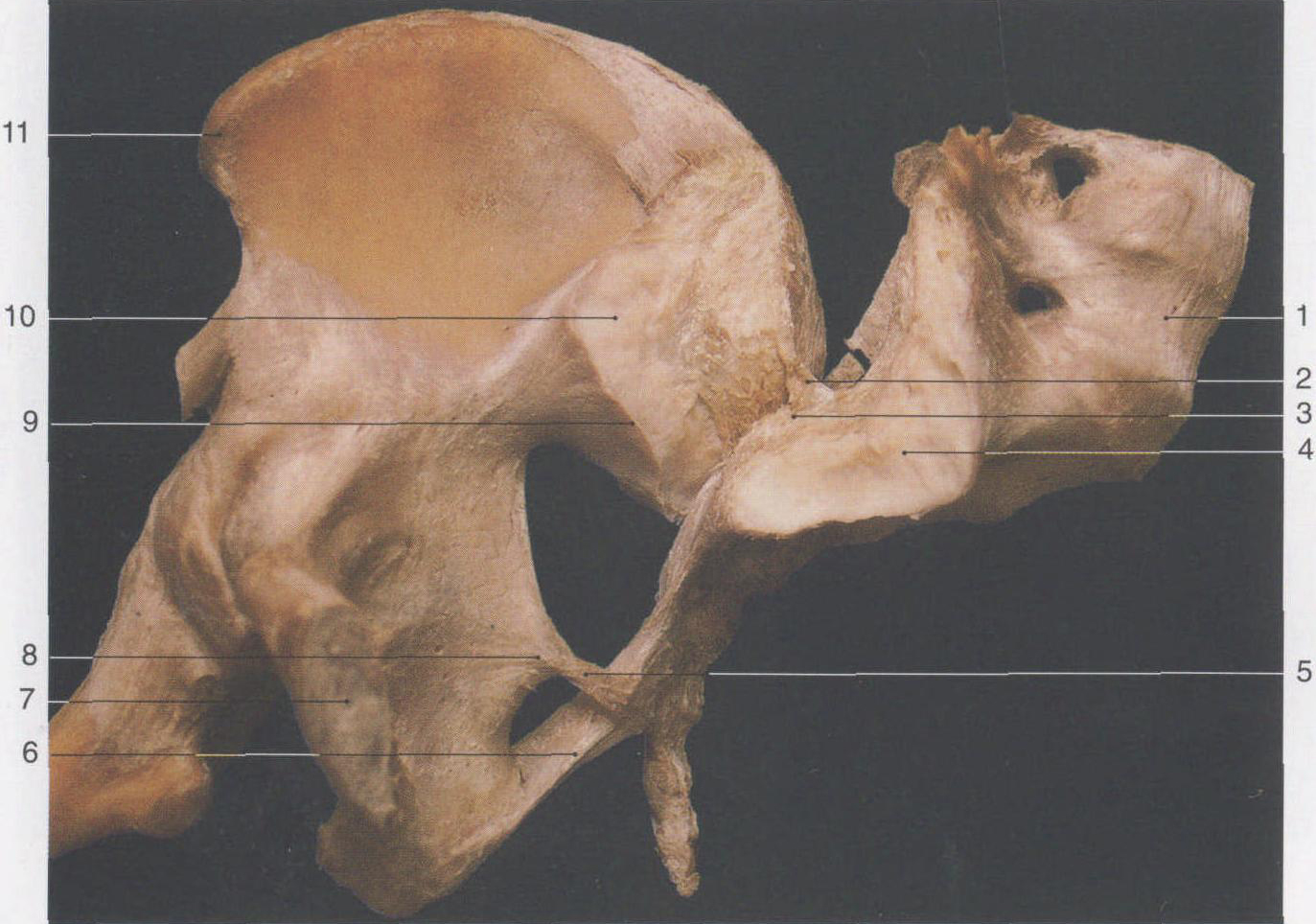 48. 骶髂關(guān)節(jié)(前面打開(kāi))